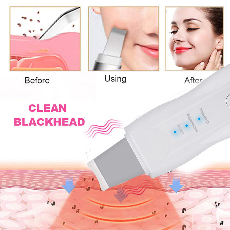 Ultrasonic Skin Scrubber