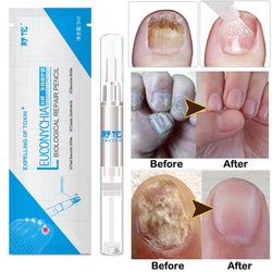 Advanced Fungal Nail Repair Pen - MediFit