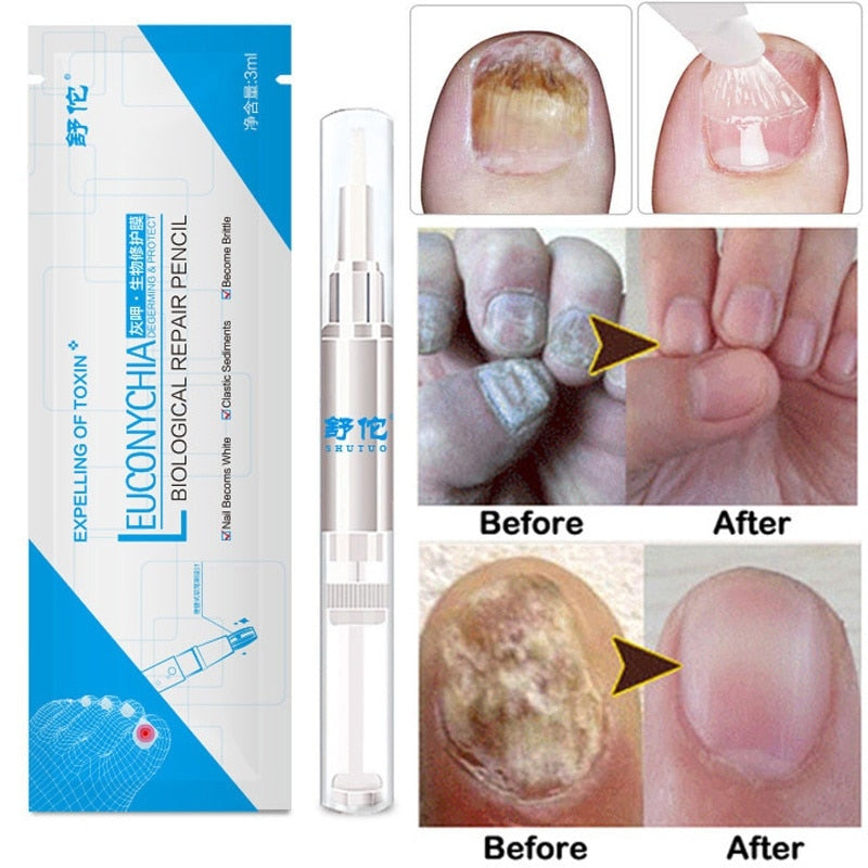 Advanced Fungal Nail Repair Pen - MediFit