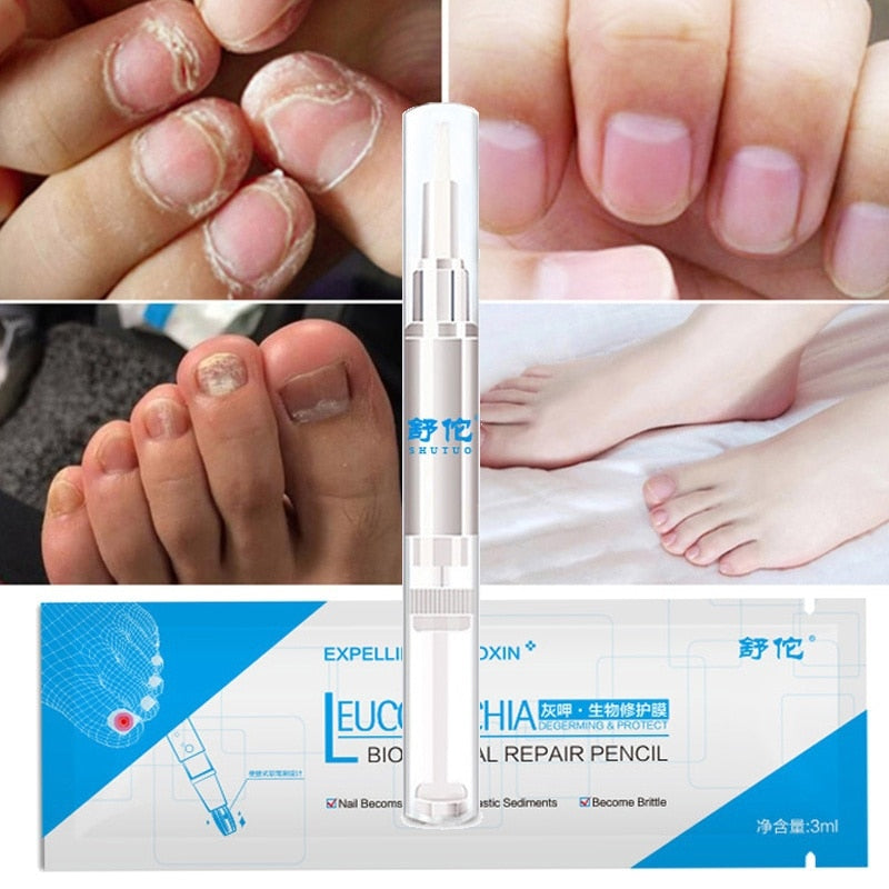 Advanced Fungal Nail Repair Pen - MediFit