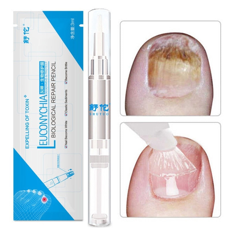 Advanced Fungal Nail Repair Pen - MediFit